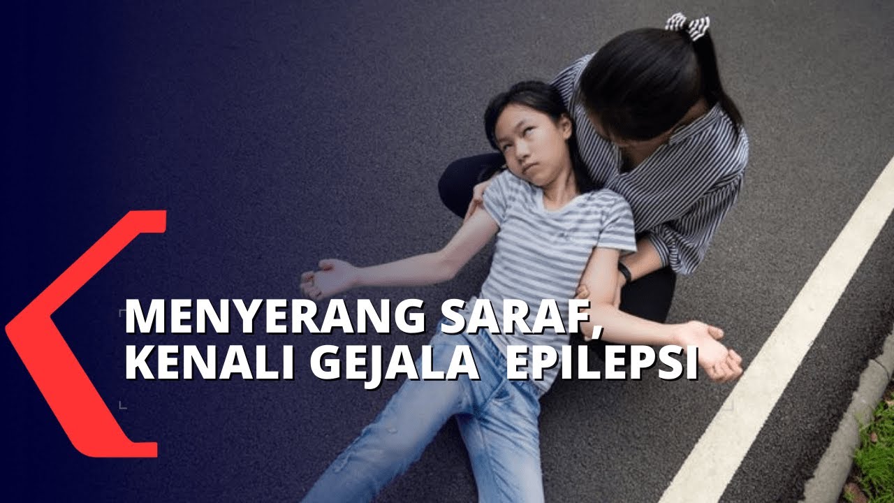 Kenali Gejala Epilepsi dan Juga Penanganannya