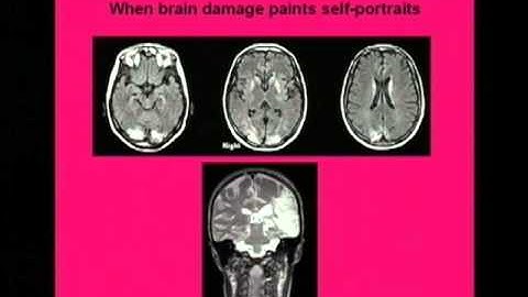 Experiment Marathon 2007: Olaf Blanke - Leaving the body behind?