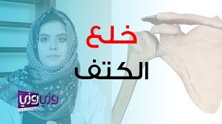 علاج خلع مفصل الكتف طبيعياً