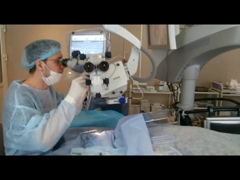 Video: Submillimeetri Retinoblastoomi Jälgimine Pärast Siirdatava Termoteraapia Kasutamist Käeshoitava Optilise Koherentsuse Tomograafia Abil
