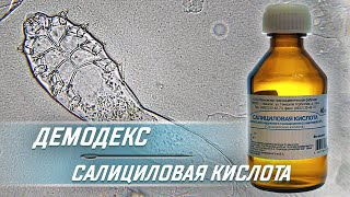 How Salicylic Acid Kills the Demodex Mite