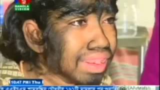 Strange BD Girl Bangladesh News 29 March 2017 Bangla News