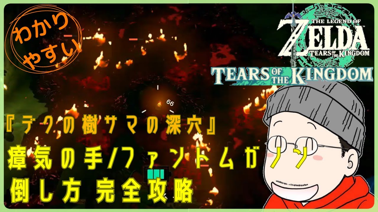 申し訳ございませんが、樹様がご購入されました。 デクの樹サマの深穴』の瘴気の手、ファントムガノンの倒し方｜ゼルダの