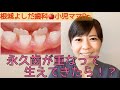 小児ママDr.『永久歯が重なって生えてきた！？』