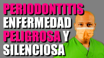 ¿Se me caerán los dientes con la enfermedad de las encías?