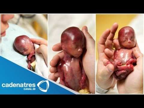 Impactantes fotografías del bebé de tan solo 19 semanas de gestación