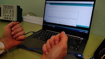 ECG amb AD8232 i Arduino Uno
