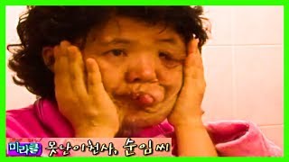 [미라클] 찌그러진 얼굴 반쪽! 나를 닮아서 딸아 미안하다! 못난이 천사, 순임 씨 | 닥터스 응급실24 응급의학과 의사 119 구급대원 의학 다큐 다시보기