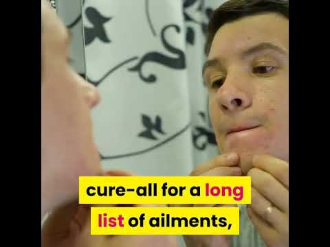 Best home remedies for acne - YouTube