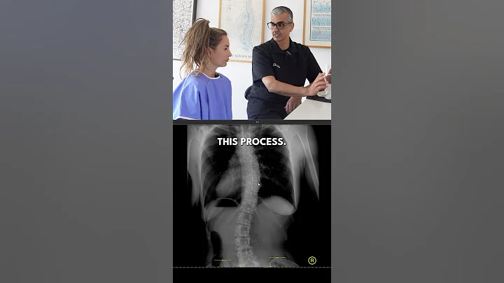 Scoliosis Low Back Pain Helped w/ Coccyx & Pelvis Adjustment #chiropractic #shorts