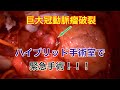 【心臓手術】 緊急 巨大冠動脈瘤破裂 Ruptured Giant Coronary Artery Aneurysm 【俺に切らせろ！】