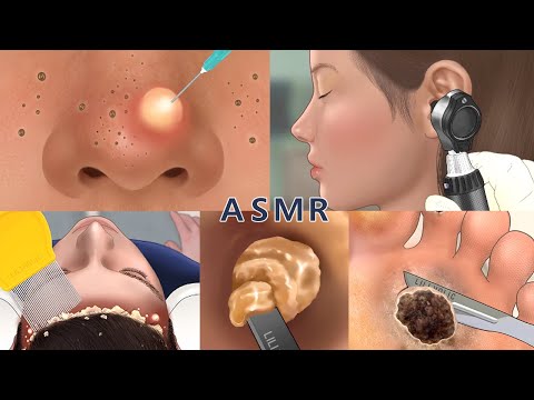 Care Animation Collection 4 (no music) | nose, foot, hair, ear care | 코피지, 발사마귀,귀청소, 머릿니