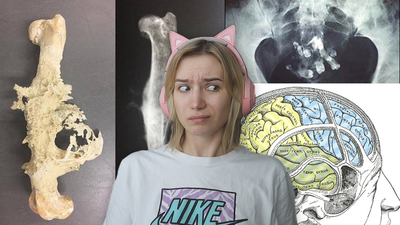 Dziwne choroby, o których nie mogę przestać myśleć