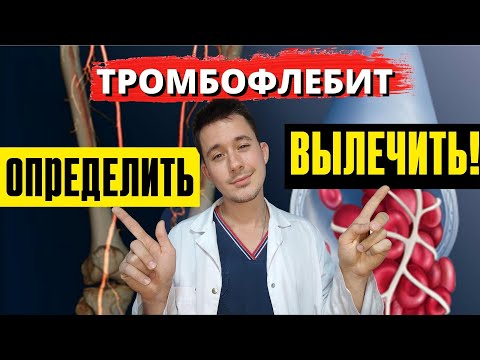 Тромбофлебит глубоких и поверхностных вен | Симптомы Лечение