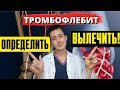 Тромбофлебит глубоких и поверхностных вен | Симптомы Лечение