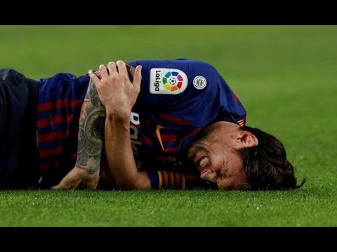 MESSI SUFRIÓ LA FRACTURA DEL RADIO DEL BRAZO DERECHO