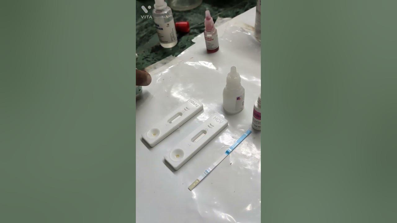 hcv-test-hbsag-test-shyplish-test-kya-hota-hai-hcv-test-in-hindi