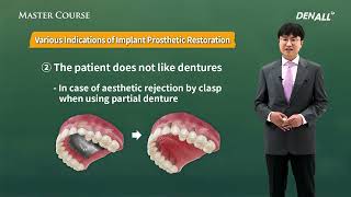 [Master Course - BASIC] Understanding and Configuring Implant Prostheses PART 1