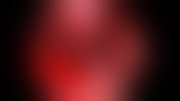 Right Inferior turbinoplasty_Sydney_Hills_ENT_Clinic