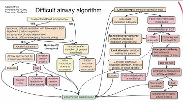 Difficult airway algorithm