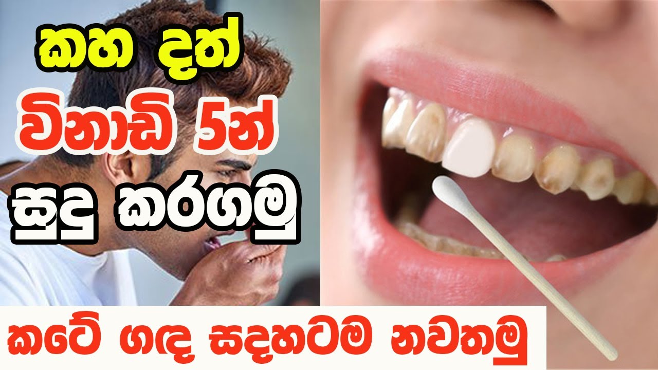 🔥Teeth Whitening and mouth smell Treatments sinhala Dath sudu