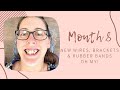 Adult Braces Month 8 | New Wires, Brackets & Rubber Band Configuration!