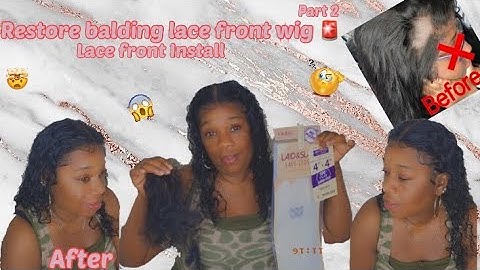 How to fix a BALDING frontal/ closure PART 2 | Lace front install !😱
