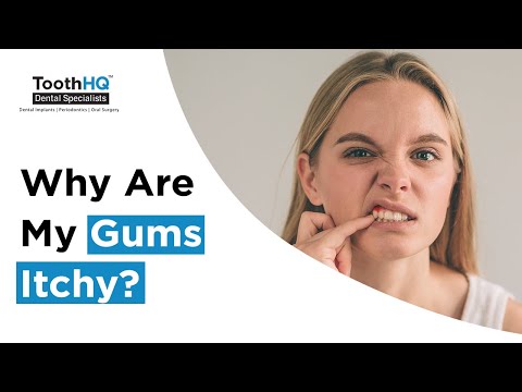 Video: Kaip sustabdyti niežtinčias dantenas (su nuotraukomis)