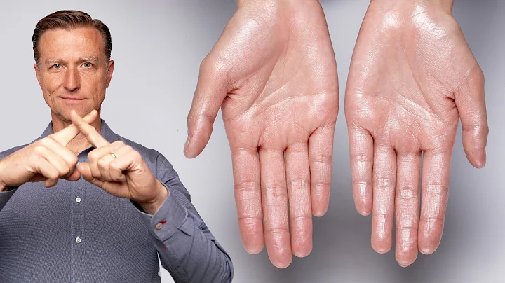 How to Stop Excessive Sweating (Hyperhidrosis) - DayDayNews