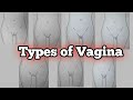 Types of Vagina | vagina types | different vagina | vagina | for educational purpose