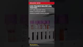 CDC Pauses Rabies & Monkeypox Testing - Breaking Shorts