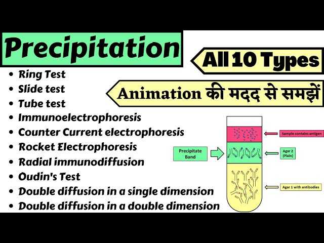 Detecting Antigen-Antibody Complexes | Microbiology