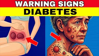 14 WARNING SIGNS YOUR BLOOD SUGAR IS TOO HIGH (DIABETES ALERT)
