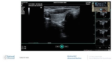 How to Measure in the Thyroid Preset on the Mindray MX7 Ultrasound Machine