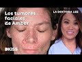 La doctora Lee y los misteriosos tumores de Amber