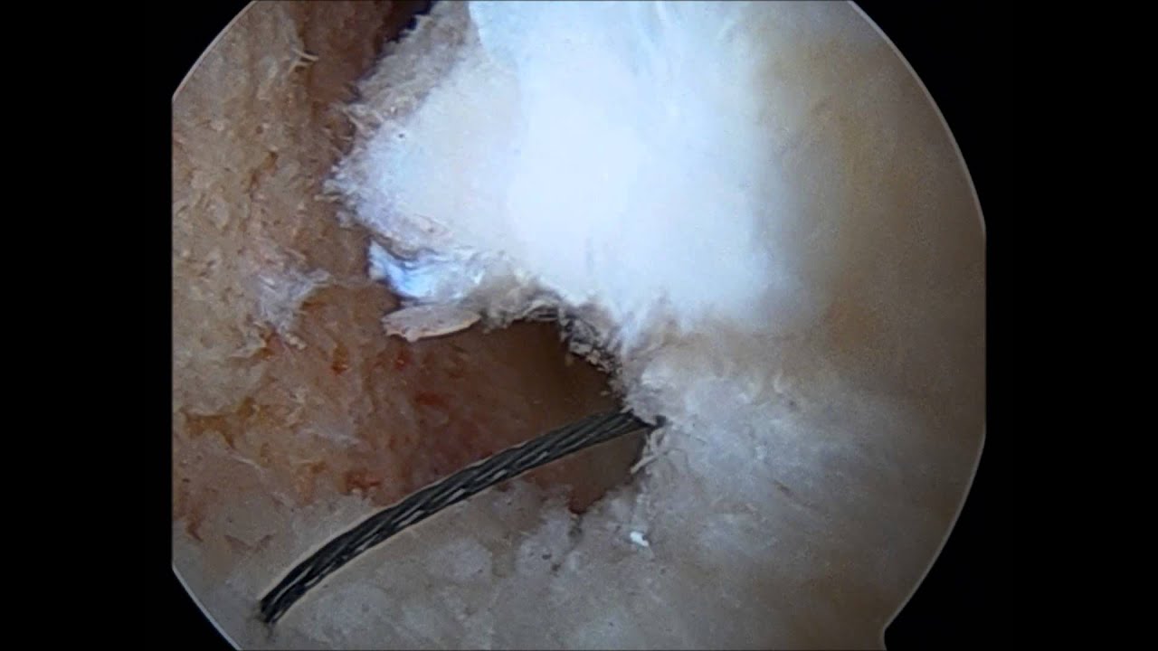 Cierre capsula T camera iphone 8 plus apk