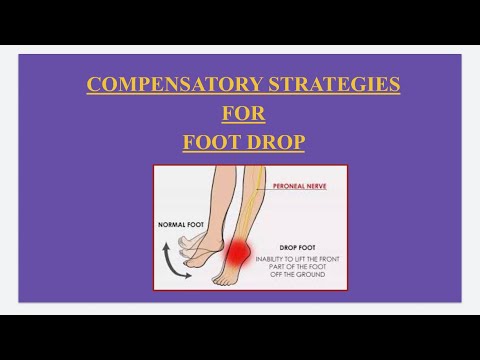 How to prevent foot drag when walking - YouTube