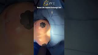 Curvy plastic surgery