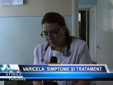 Video: Varicela - Cauze, Simptome Si Tratamentul Varicelei