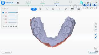 Shining 3D Aoralscan 3 | Next-Gen Intraoral Scanner screenshot 1