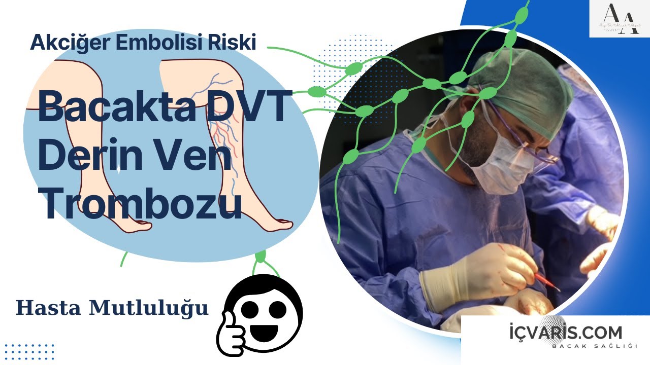 Derin Ven Trombozu (DVT) ve Akciğer Embolisi: Hayati Tehlike! | Prof. Dr. Ahmet Akgül