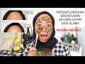 CARA MENGHILANGKAN BRUNTUSAN DENGAN CEPAT DAN ALAMI 😱👍🏻✨