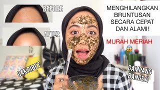 Skincare Routine Untuk Kulit Bruntusan/Fungal Acne