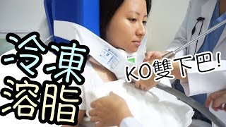 冷凍溶脂去雙下巴！每周醫美減肥分享WEEK#1｜陳怡 ChanYee