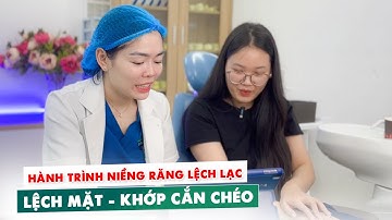 Hành Trình Niềng Răng Lệch Lạc - Lệch Mặt - Khớp Cắn Chéo Đầy Thử Thách | Cận Cảnh Gắn Mắc Cài
