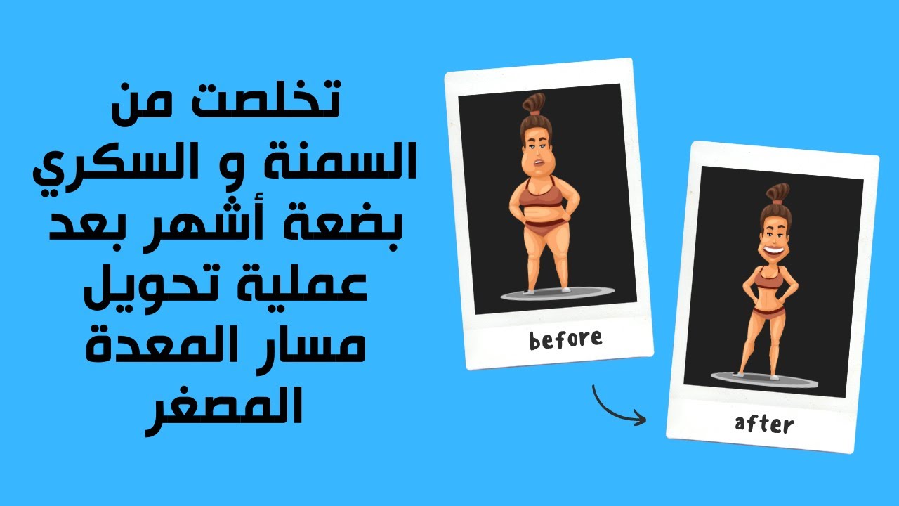 تخلصت من السمنة و السكري بضعة أشهر بعد عملية تحويل مسار المعدة المصغر..شكرا د منير بن شتوح