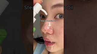 Best Way To Remove Blackheads