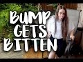 Bump Gets Bitten | NomadiDaddy