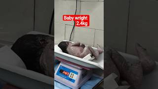 baby weight 2.4kg #normal delivery #baby #newborn #pregnancy