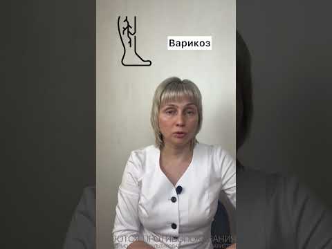Если отекают ноги Доктор Лисенкова #shorts